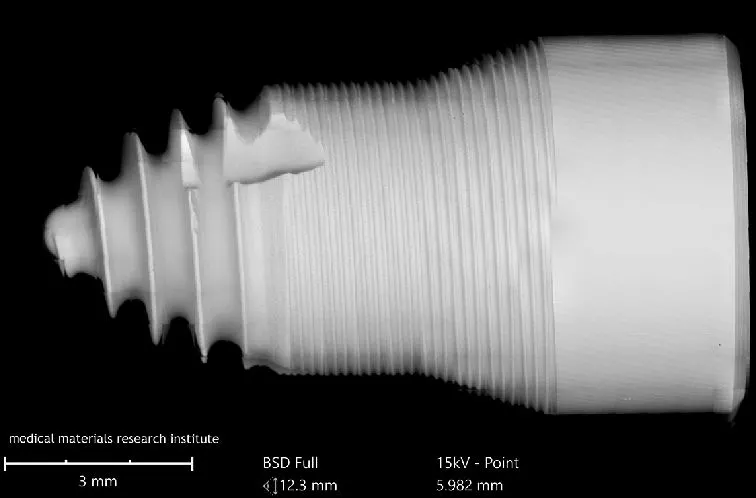 Nachweislich saubere Oberfläche des SDS2.2 Implantats im Rasterelektronenmikroskop (aus 400 REM Einzelbildern zusammengesetzte Darstellung des gesamten Implantats in höchster Auflösung).