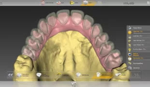Das Update auf Version 18.0 bereichert die inLab Software um neue Funktionen wie das Design von Multilayer-Gingivabrücken. Über diese und viele weitere Möglichkeiten der Labor-Software informieren die inLab Software Anwenderkurse.