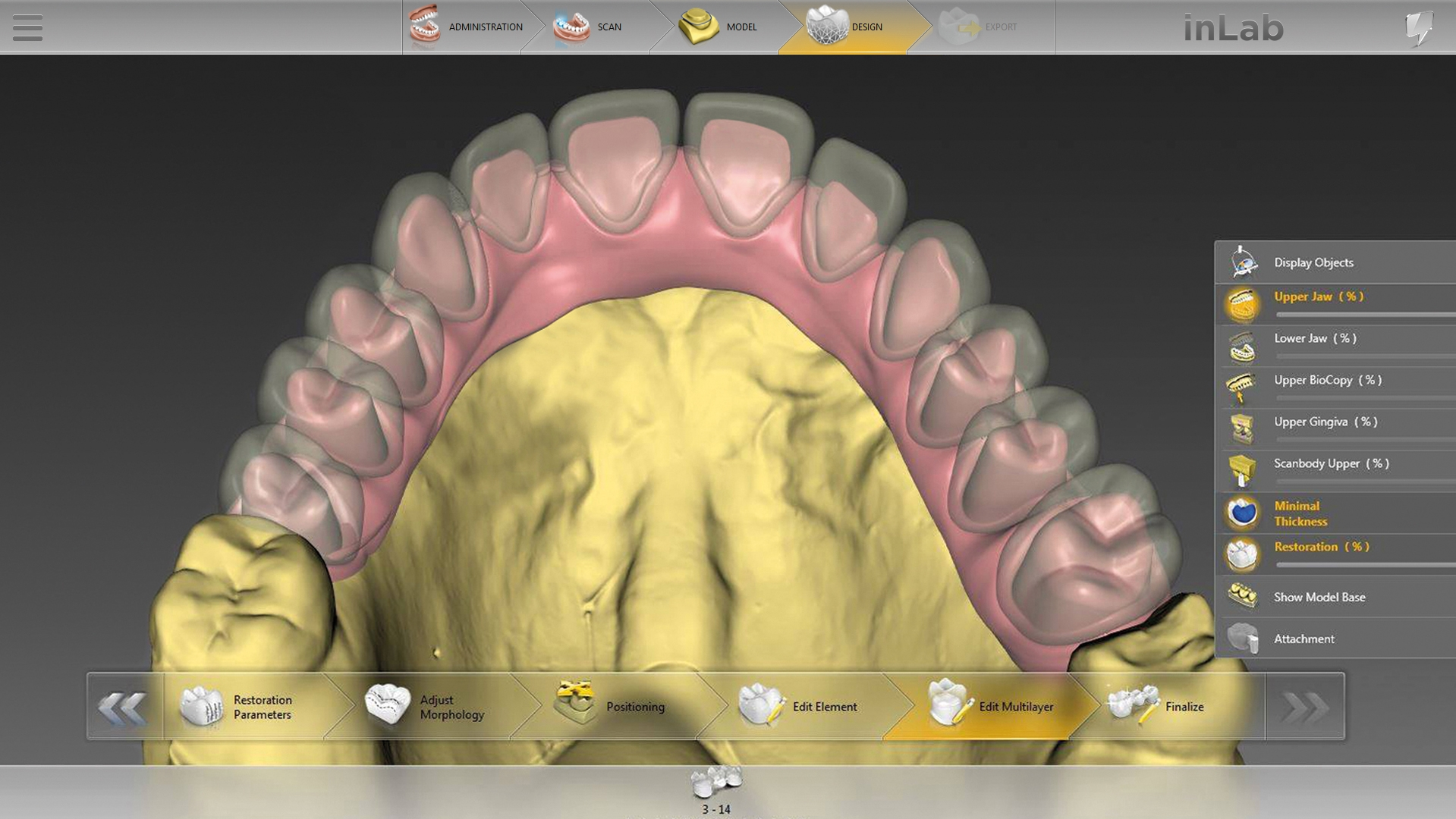 Das Update auf Version 18.0 bereichert die inLab Software um neue Funktionen wie das Design von Multilayer-Gingivabrücken. Über diese und viele weitere Möglichkeiten der Labor-Software informieren die inLab Software Anwenderkurse.