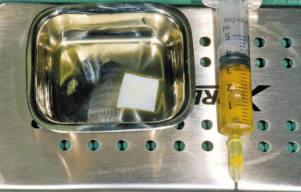 Abb. 5: Flüssiges L-PRF mit Novomatrix.