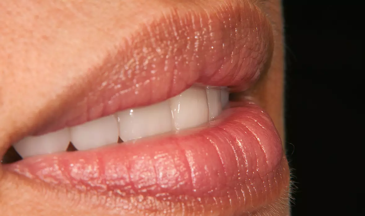 Abb. 48: Lippenbild.