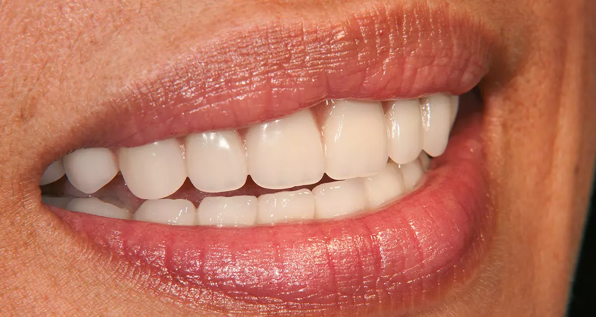 Abb. 49: Lippenbild.