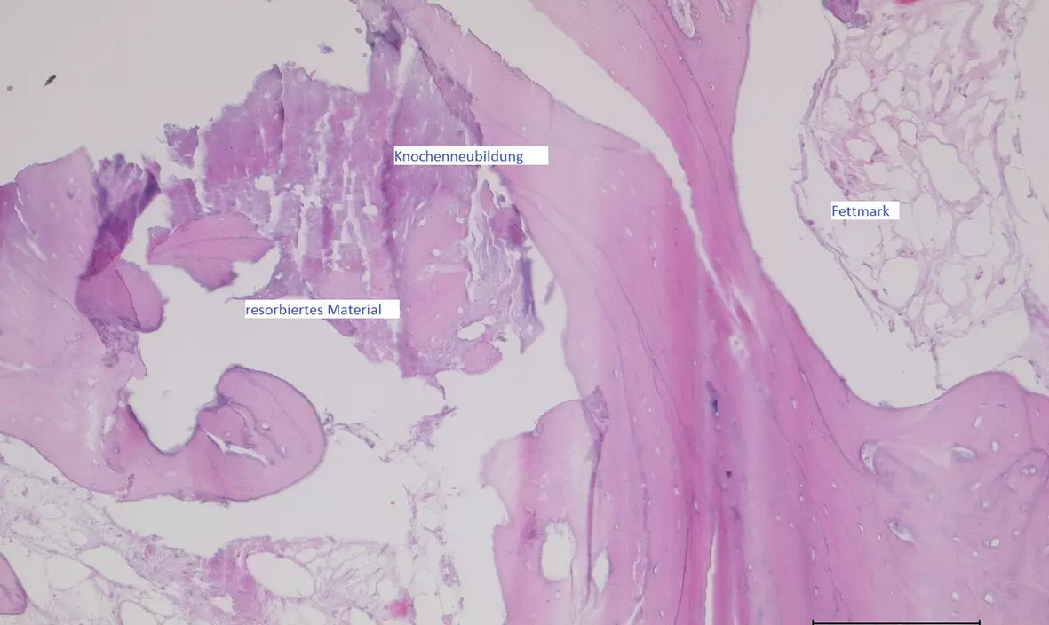 Abb. 23: Histologische Untersuchung der Knochenneubildung.