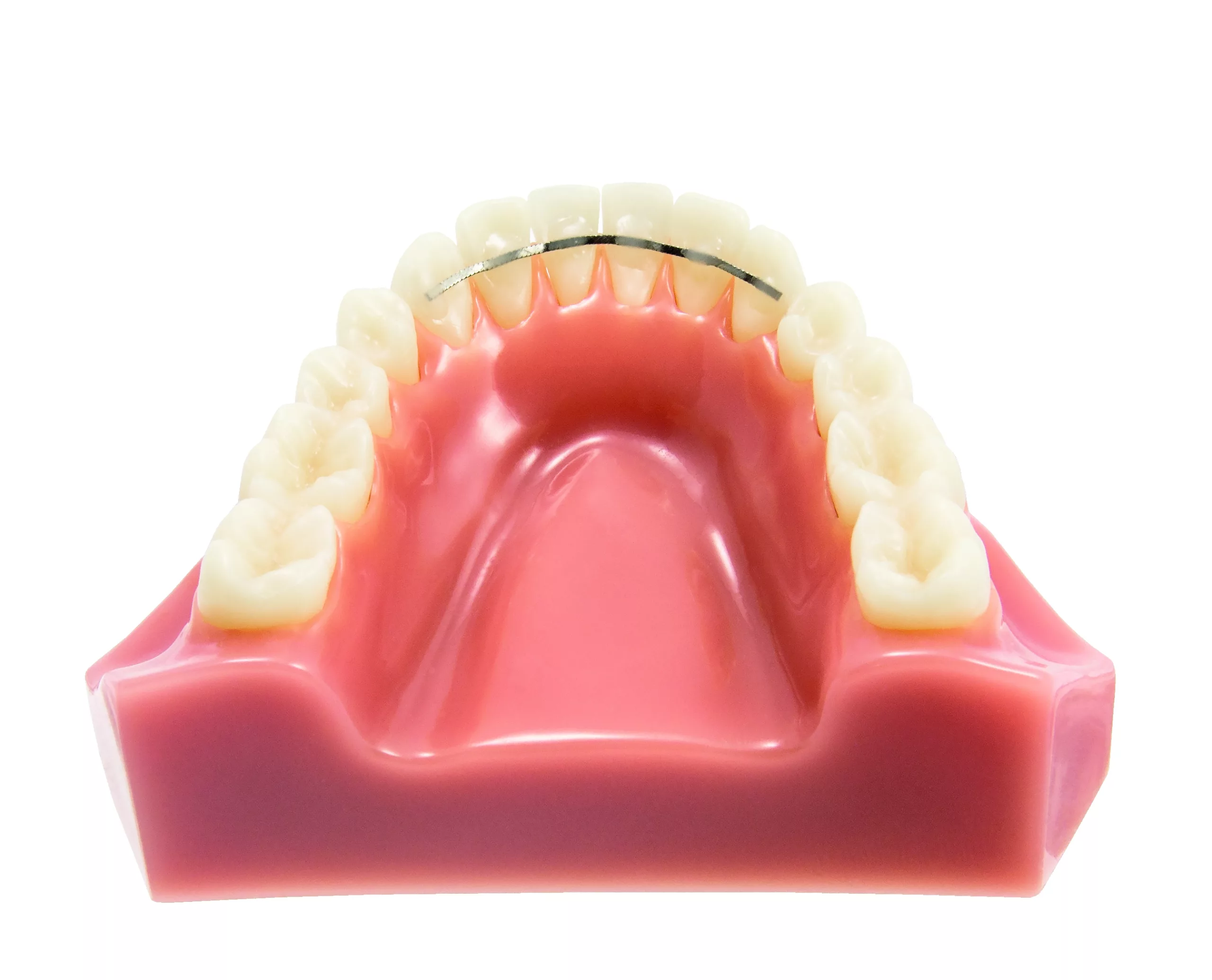 Super flach: Der neue rematain® flat Retainerdraht.