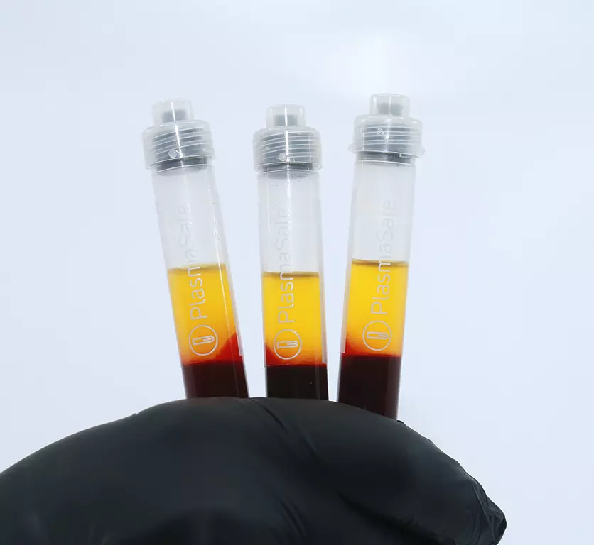 Flüssiges PRP oder Liquid Plasma Concentrate.