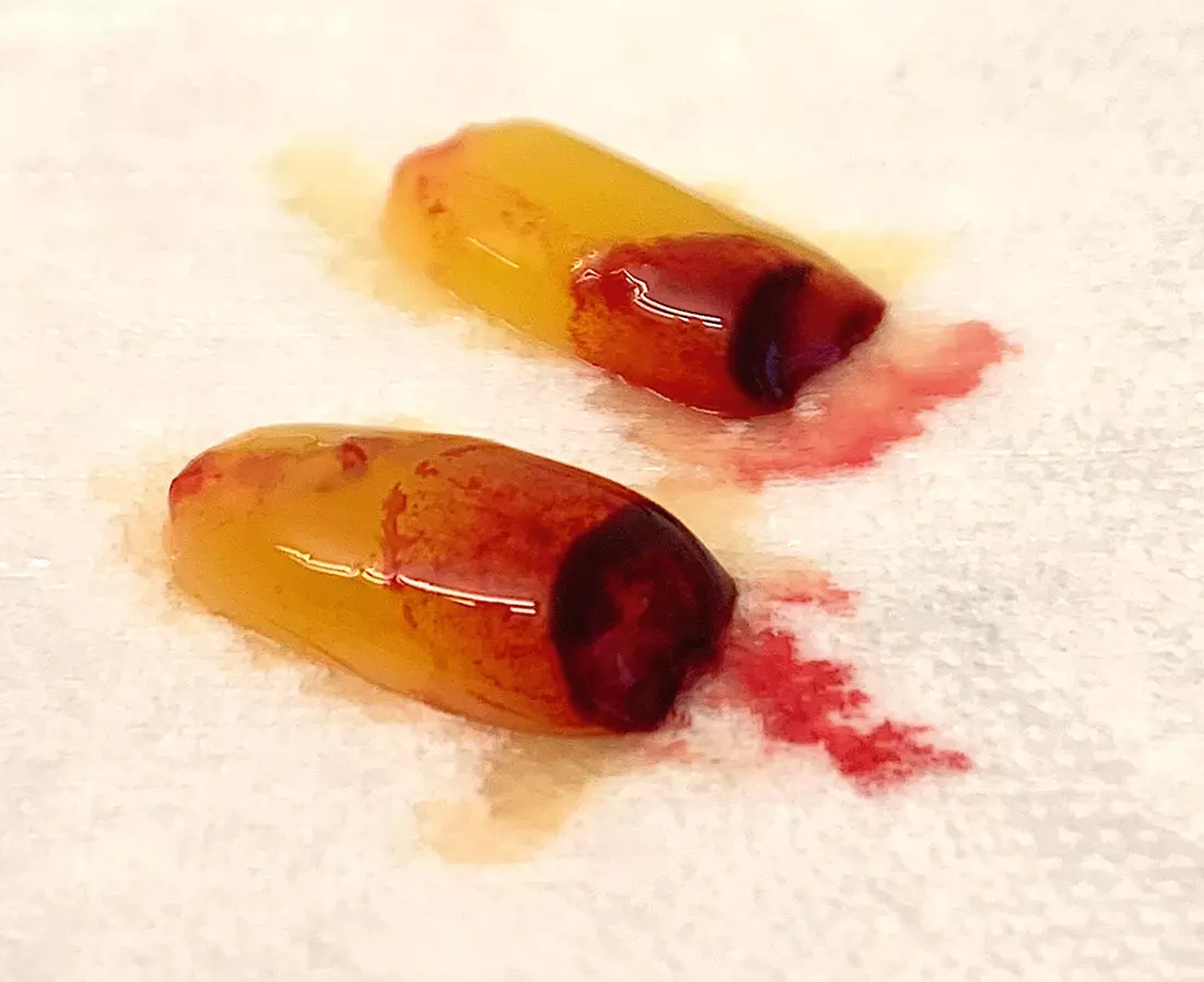 Fibrin Clot.