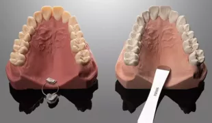 .
