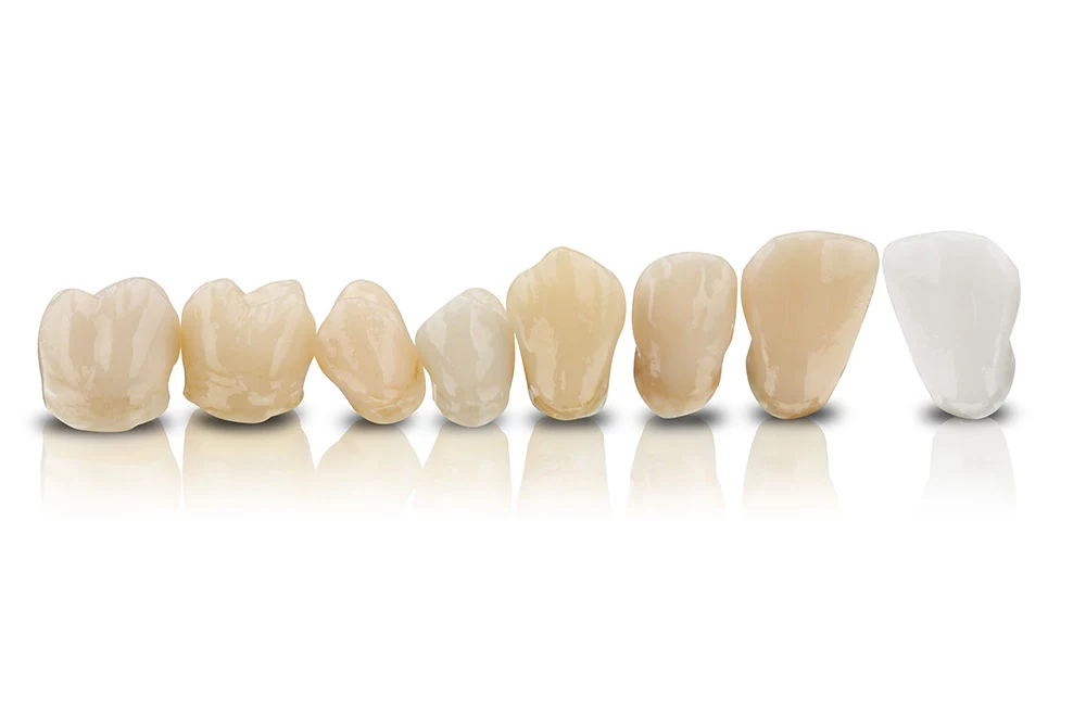 Das breite Farbspektrum von VarseoSmile Crown plus für permanente 3D-Druck-Versorgungen (A1, A2, A3, B1, B3, C2, D3) wurde nun um die Farbvariante BEGO Bleach erweitert.