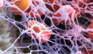 Fibrinnetzwerk auf superhydrophiler, mikrorauer Thommen-Oberfläche.