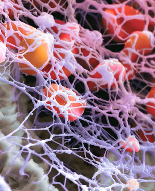 Fibrinnetzwerk auf superhydrophiler, mikrorauer Thommen-Oberfläche.