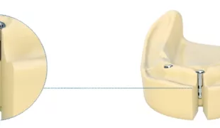 Dentaurum Implants stellt das neue tioLogic® TWINFIT Laborimplantat vor.