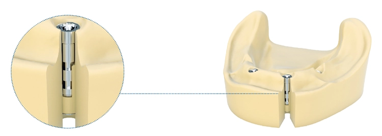 Dentaurum Implants stellt das neue tioLogic® TWINFIT Laborimplantat vor.
