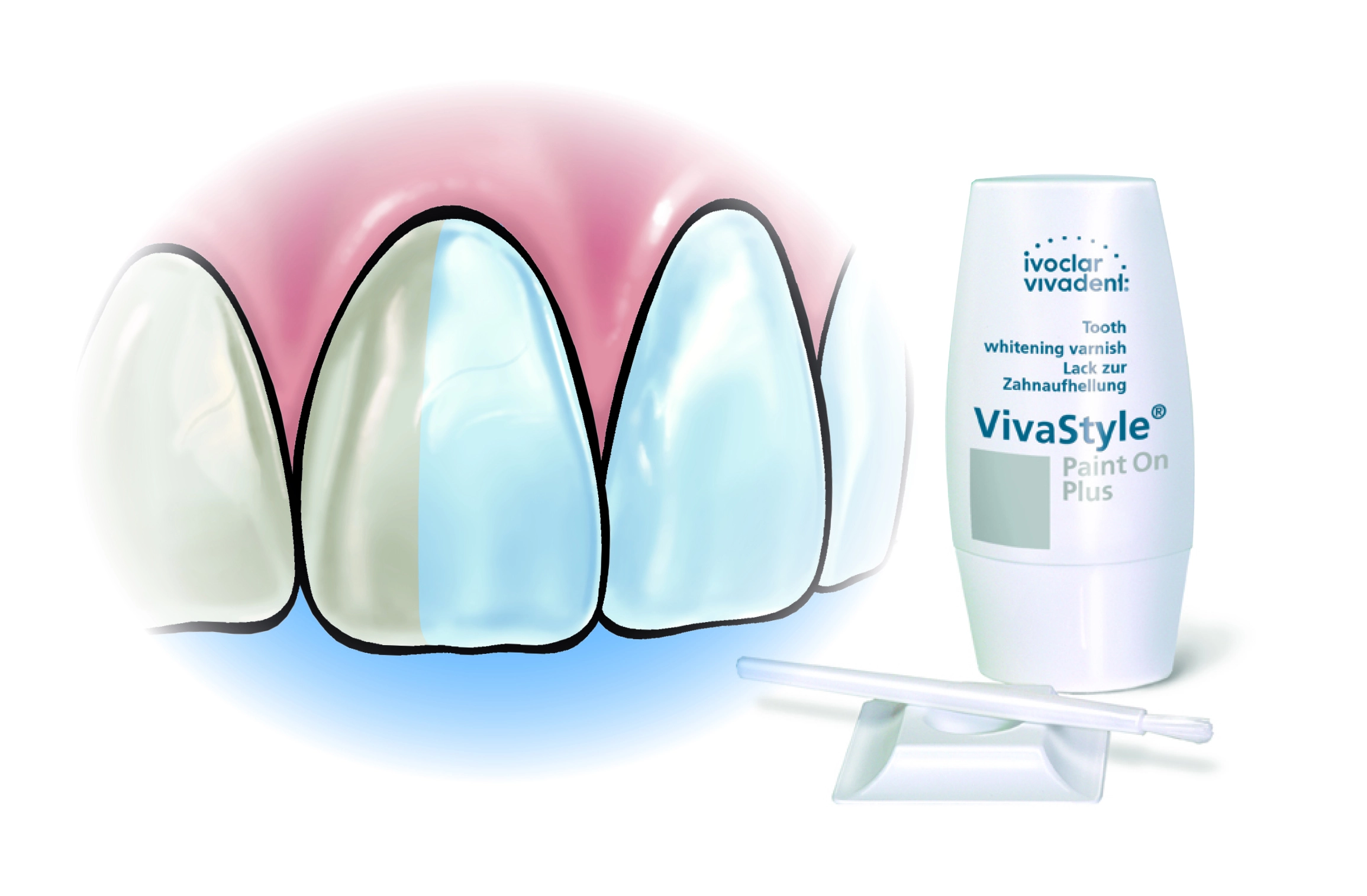 VivaStyle Paint On Plus stammt aus dem Hause Ivoclar Vivadent.