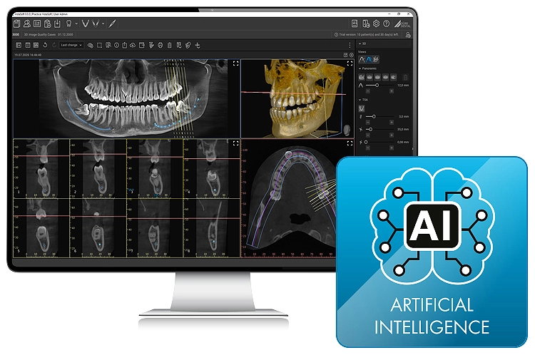 AI-gestützte Mandibularkanaldetektion mit VistaSoft 3.0